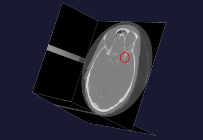 Figure1